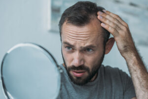 Man looking upset while examining his hair loss in the mirror, considering whether Dutasteride or Finasteride is the best treatment option.