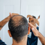 A man examining his baldness in the mirror, reflecting concerns about hair loss and potential treatments such as medications, over-the-counter solutions, and hair transplant options.