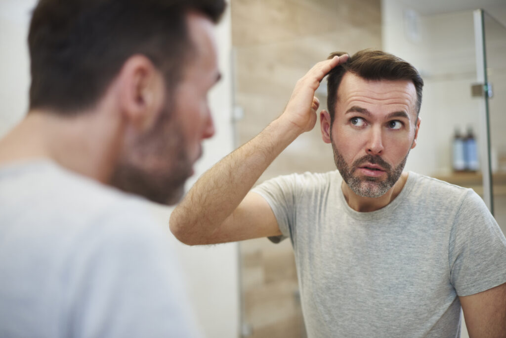 Man looking worried about hair loss, reflecting on common myths and seeking solutions for his condition.