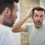 Man looking worried about hair loss, reflecting on common myths and seeking solutions for his condition.