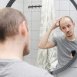 Man examining his hair loss in the mirror, concerned about male-pattern baldness and looking for solutions.