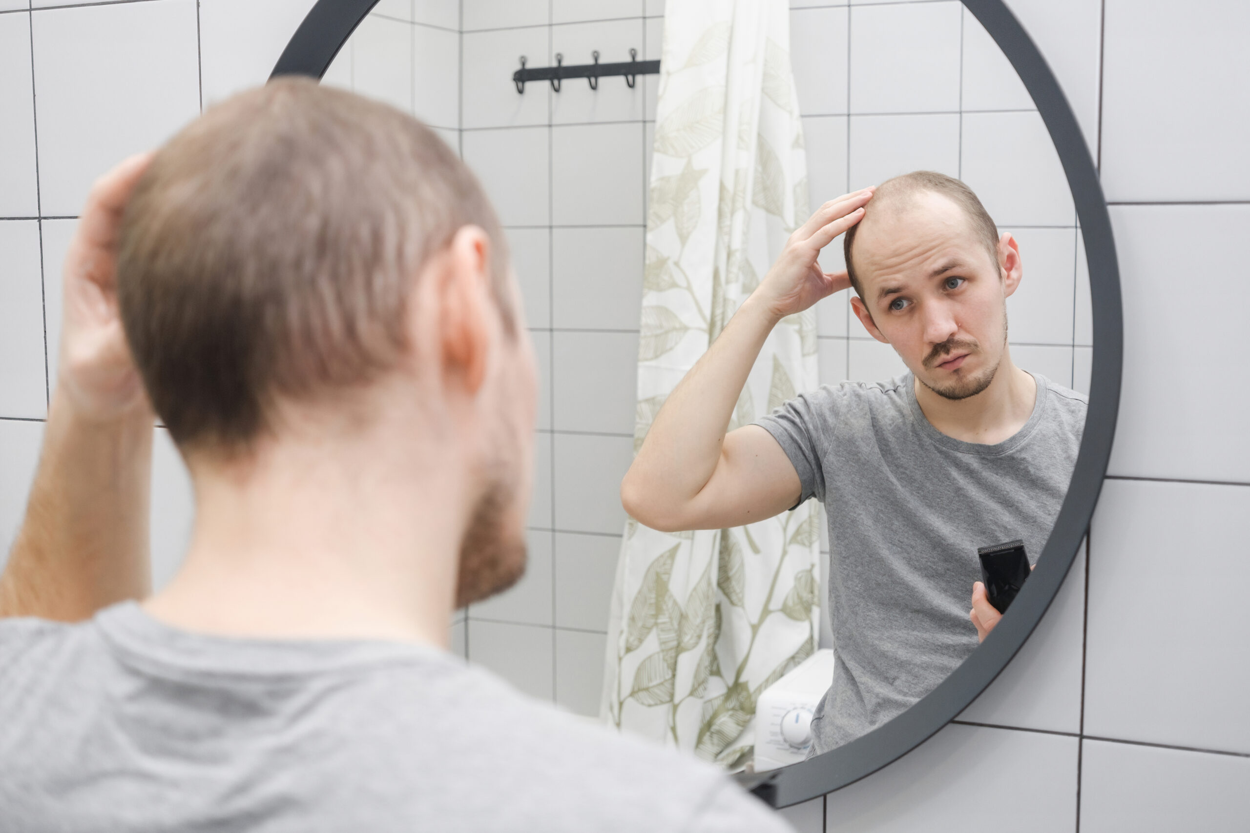 Man examining his hair loss in the mirror, concerned about male-pattern baldness and looking for solutions.