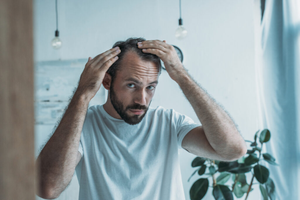 Adult man examining his reflection in the mirror, representing the journey of understanding hair loss and exploring natural treatments.